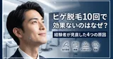 ヒゲ脱毛10回で効果ないのはなぜ？経験者が見直した4つの原因