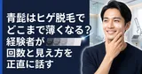 青髭はヒゲ脱毛でどこまで薄くなる？経験者が回数と見え方を正直に話す