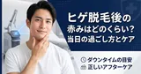 ヒゲ脱毛後の赤みはどのくらい？当日の過ごし方とケア